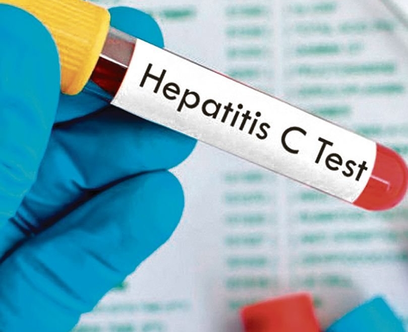 Hepatitis C: de pelear por los medicamentos a salir a buscar pacientes