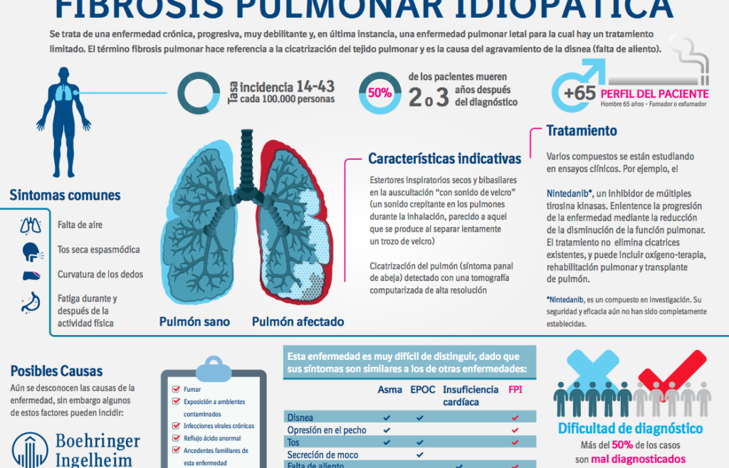 El reto de vivir con Fibrosis Pulmonar Idiopática