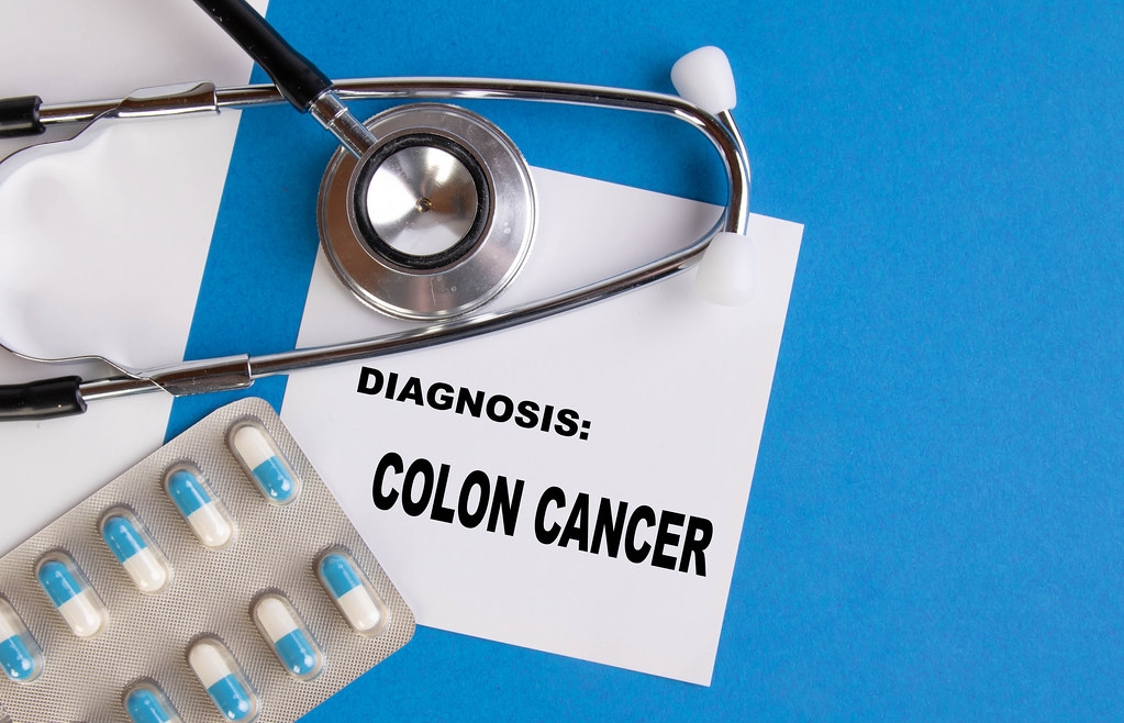 Cáncer de colon: el 90% de los casos se curan por un diagnóstico a tiempo